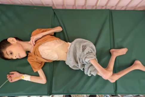 加沙供水系統(tǒng)破損導致兒童患病