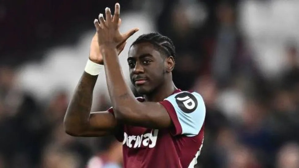 迪文&middot;穆巴馬即將轉(zhuǎn)會(huì)曼城，但需要支付醫(yī)療費(fèi)和賠償費(fèi)